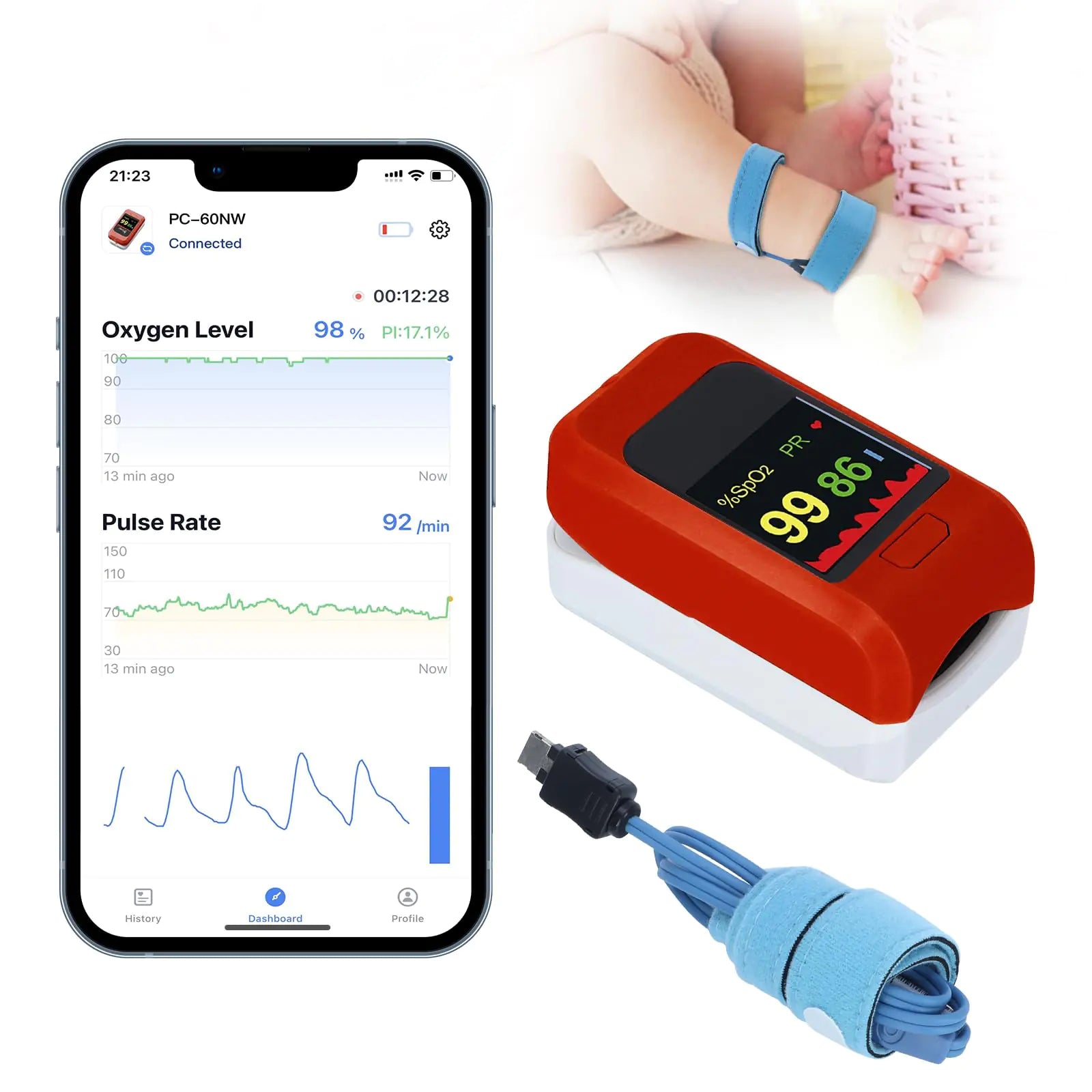 🍼 OxyGuardian™ Baby Monitor – Real-Time Oxygen & Heart Rate Tracker 👶📱